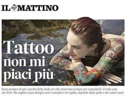 Togliere un tatuaggio è molto più difficile che farlo